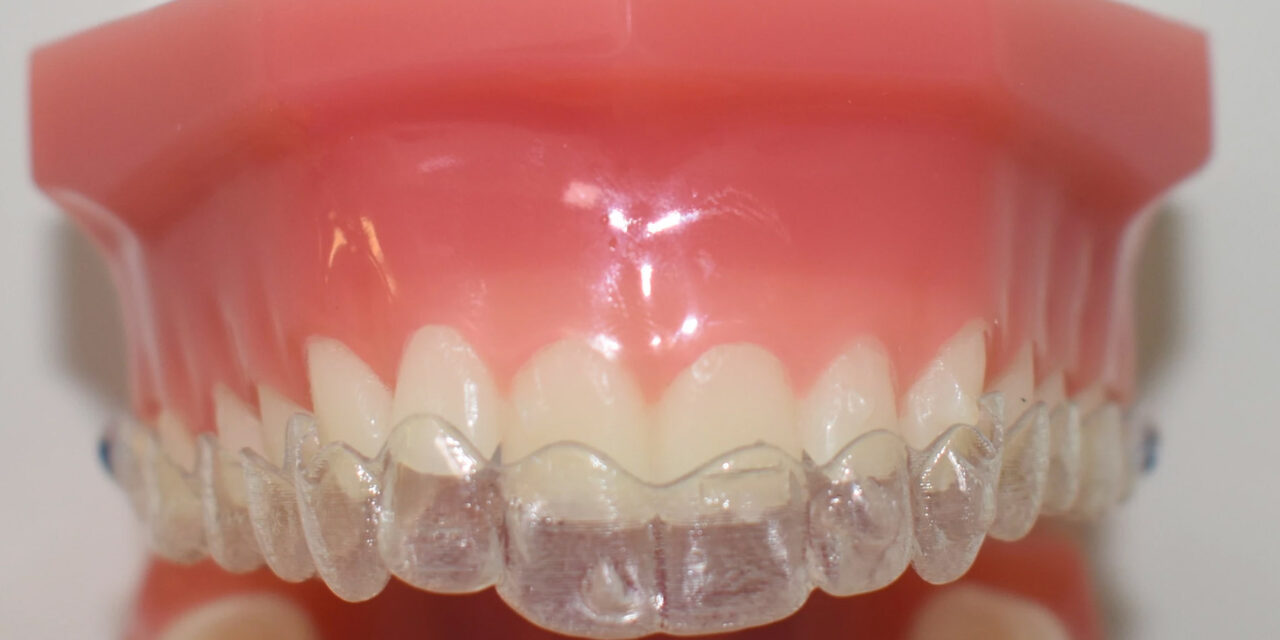 Ortodonzia con Invisalign vs coronavirus