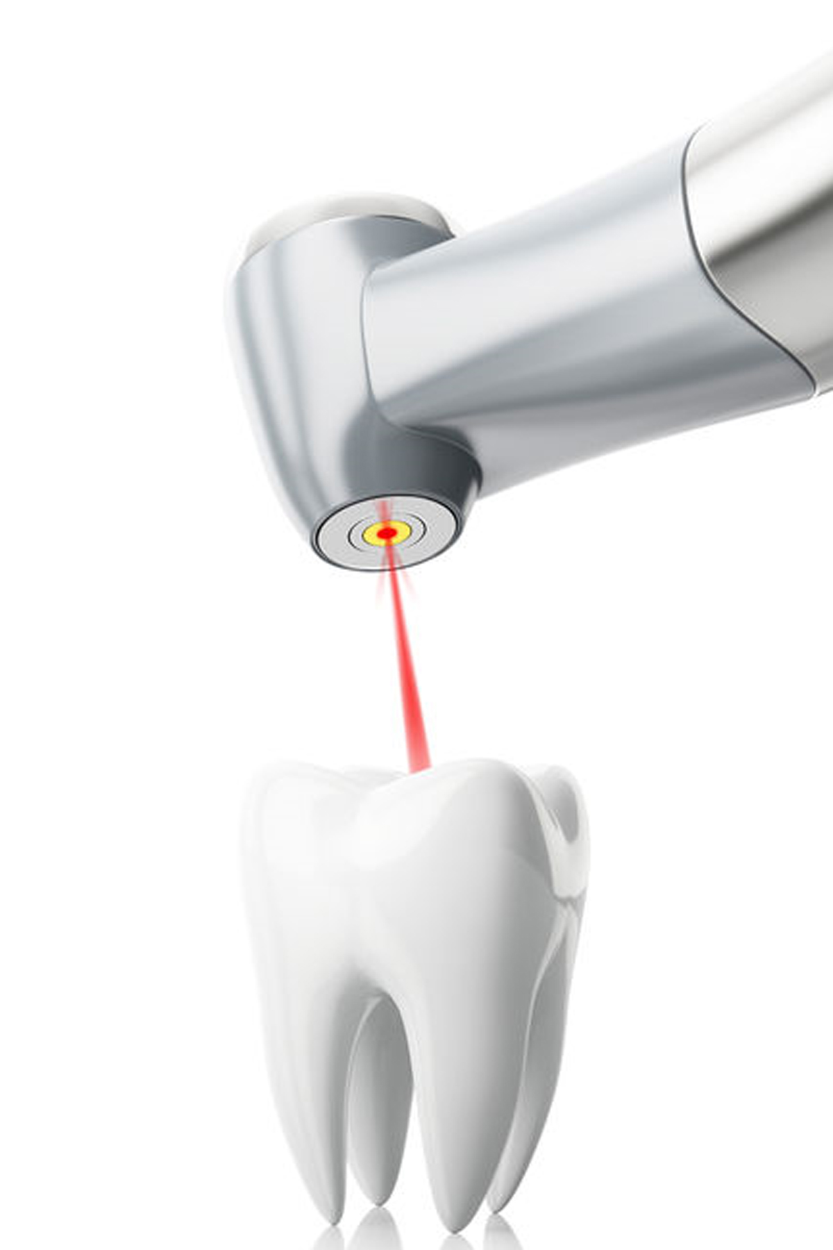 https://www.studiodentisticoberri.it/wp-content/uploads/2022/07/laser-in-odontoiatria-studio-berri.jpg