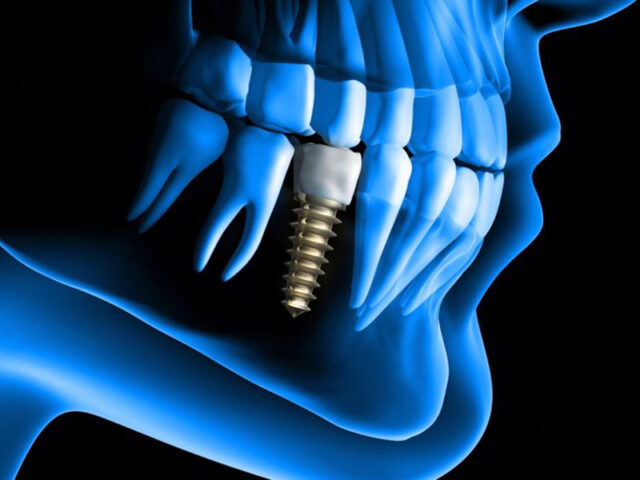 <img src="la-teleradiografia-latero-laterale.jpg" alt="radiografia">