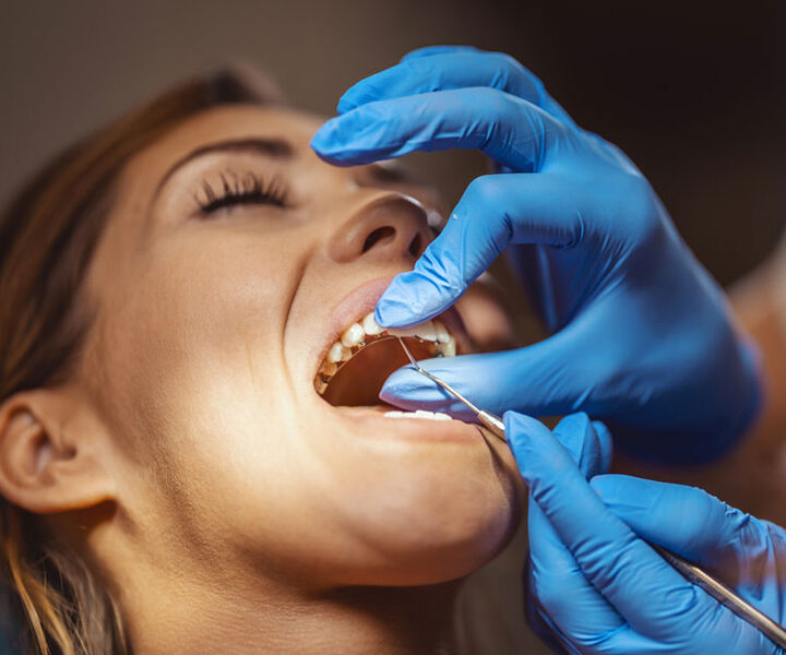 Come faccio a mantenere i denti dritti dopo l’ortodonzia?