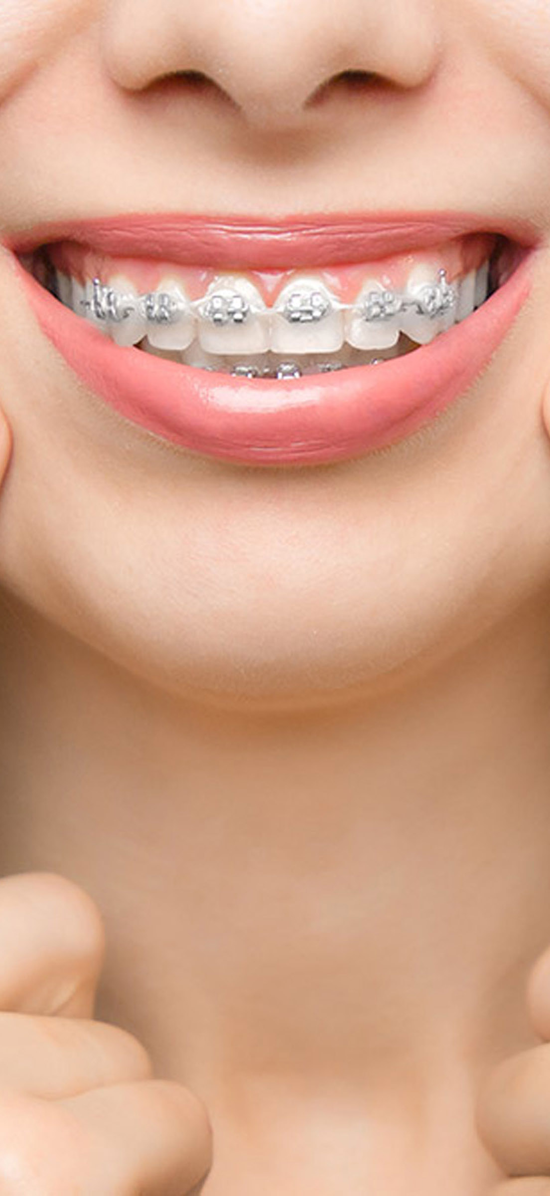 https://www.studiodentisticoberri.it/wp-content/uploads/2023/06/StudioBerri-sin_2.jpg
