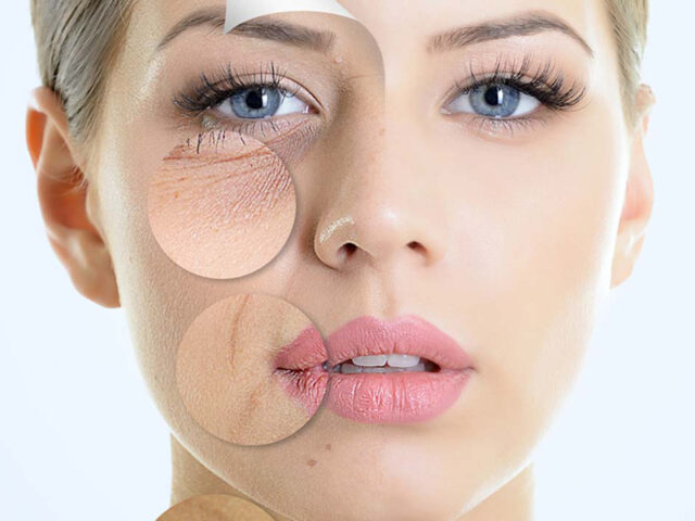 <img src="i filler.jpg" alt="i filler">