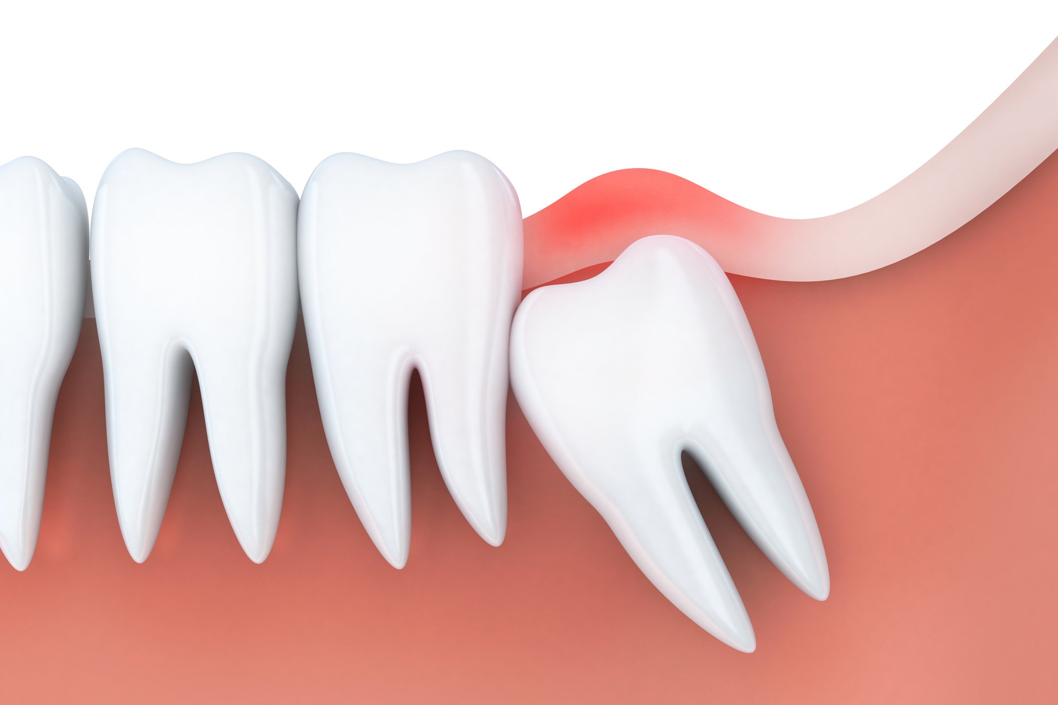 dente del giudizio